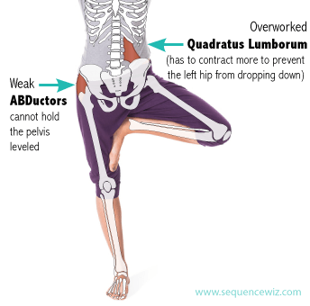 Showing the tilt in the lumber from weak abductors